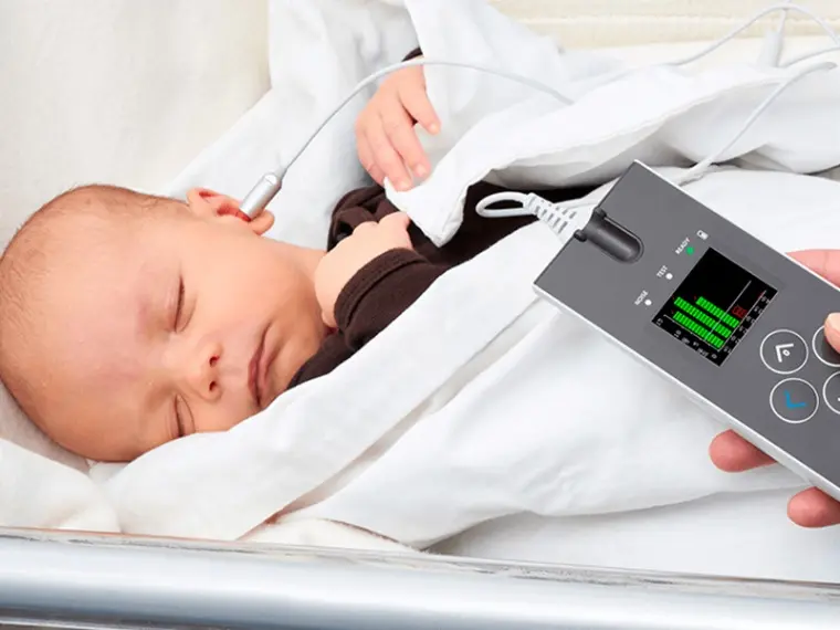 OAE (Otoakustik Emissiya)